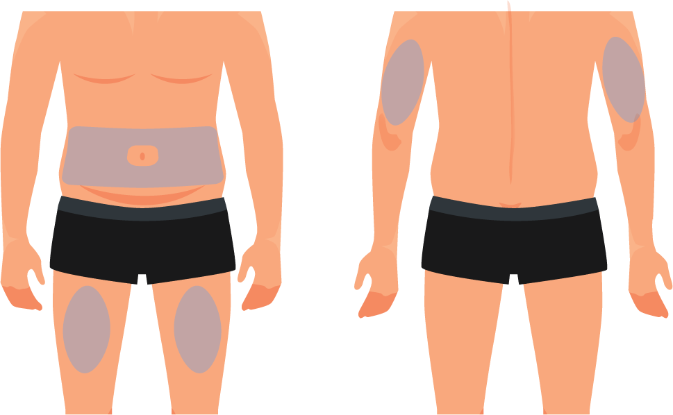 Where to inject diagram